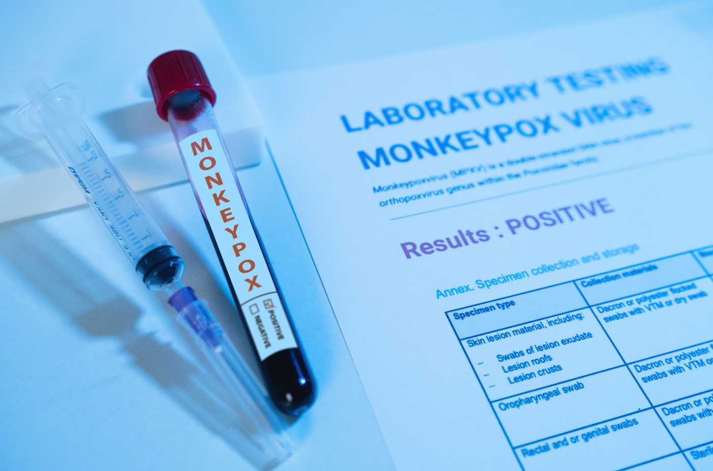 Im Lahn-Dill-Kreis ist der erste laborbestätigte Fall von Affenpocken aufgetreten. Foto: somboon kaeoboonsong/via canva.com